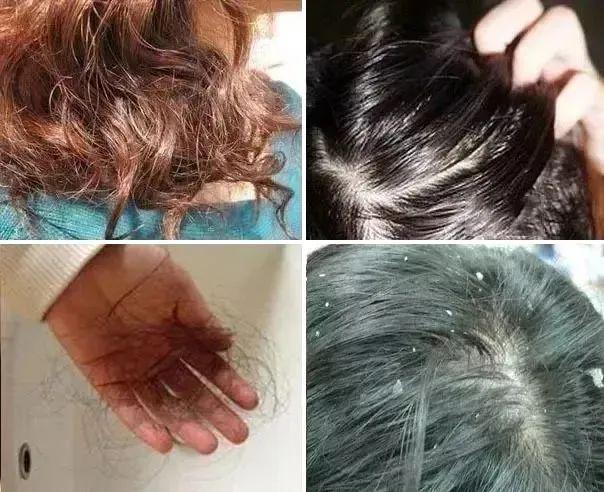 头屑多？头发油？澳洲Pote植酵舒缓专利控油去屑洗发水系列爆卖10w+！(图3)