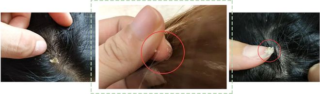 头屑多？头发油？澳洲Pote植酵舒缓专利控油去屑洗发水系列爆卖10w+！(图5)