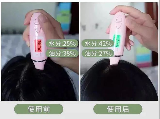 头屑多？头发油？澳洲Pote植酵舒缓专利控油去屑洗发水系列爆卖10w+！(图26)